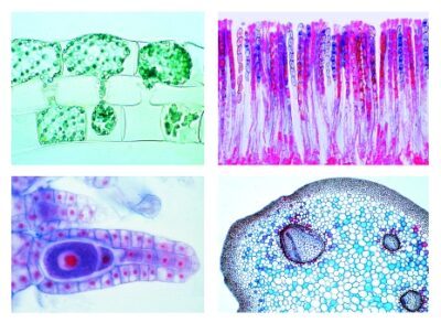 Crittogame, set elementare, 25 vetrini per microscopio