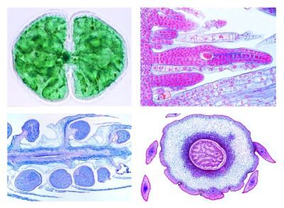 Crittogame, set supplementare II, 25 vetrini per microscopio