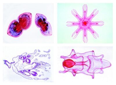 Diversi tipi di larve, 10 preparati microscopici (NUOVO)