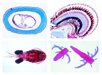 Zoologia, set di dettagli, crostacei, 15 vetrini microscopici
