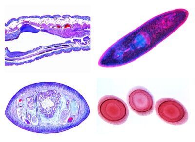 Zoologia, set di dettagli, Vermes (Elminti), 20 vetrini per microscopio
