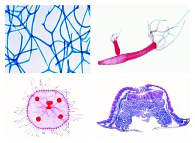 Zoologia, Set di dettagli, Poriferi e Celenterati, 10 preparati microscopici (Nuova versione)