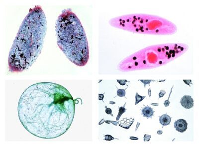 Zoologia, set di dettagli, protozoi, 10 preparati microscopici