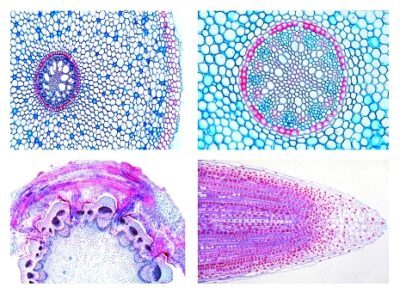 Angiosperme, set di dettagli, radici, 15 vetrini microscopici