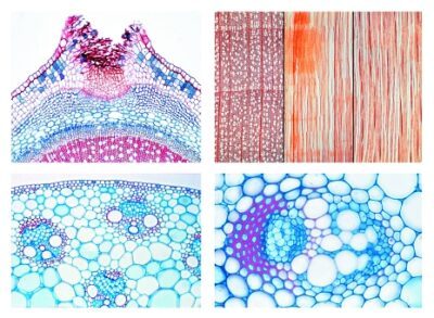 Angiospermae, set di dettagli, steli, 20 vetrini per microscopio