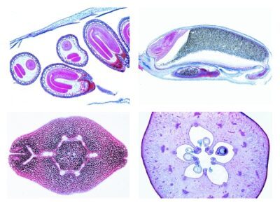 Angiospermae, Set di dettagli, Frutti e semi, 15 vetrini microscopici