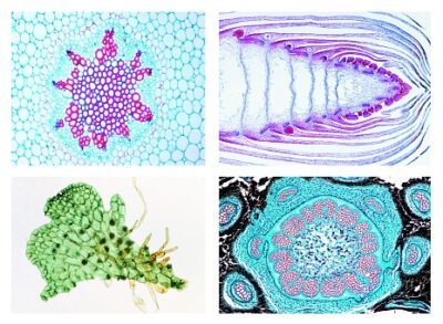 Crittogame. Set di dettagli, Pteridofite (felci e felci alleate), 15 vetrini microscopici