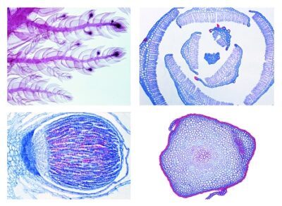 Crittogame. Set dettagliato, Bryophyta (epatiche e muschi), 15 vetrini microscopici