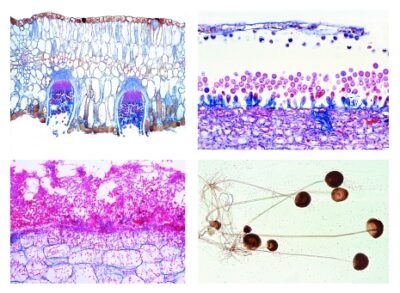 Agricoltura e selvicoltura, Parte I. Funghi nocivi come causa di malattie delle piante. 20 microscopi preparati