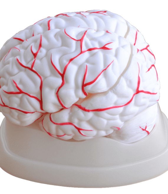 mod-brain1-1677872166.png