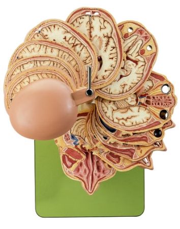 Modello anatomico in sezione della testa (combinato con le corrispondenti figure MR)