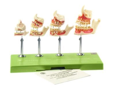 Sviluppo di una serie di denti