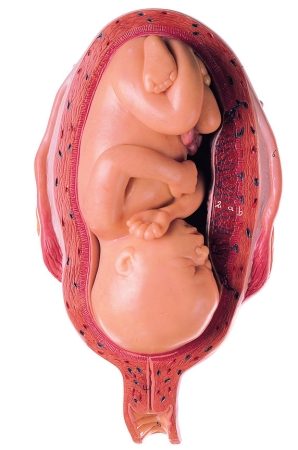 Utero con feto al settimo mese