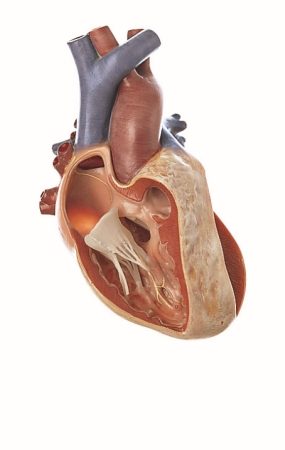 Tetralogia di Fallot