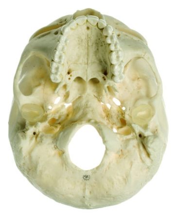 Base del cranio