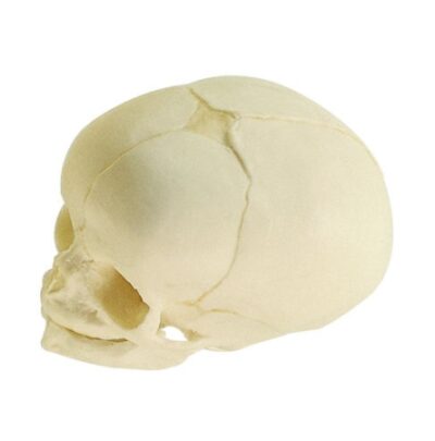 Cranio artificiale di un feto