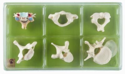 Valigetta con Collezione (Vertebre e Midollo Spinale)