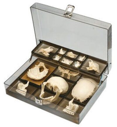 Cranio artificiale di Bauchene di un adulto